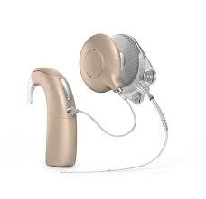 Image result for Cochlear Implant