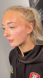 1.1ml Advanced/Russian Lips 🤍