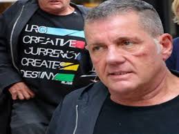 Dale Winton worries fans with shocking new look