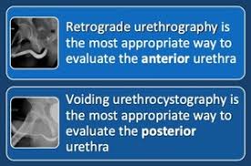 Image result for Retrograde Urethrogram
