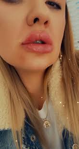 💋 Winner no 46 Khloe Jackson 💋