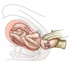 Image result for delivery baby