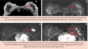 Breast Imaging At Star