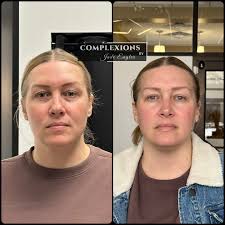 ➡️ DAY 55 of 365. Have you booked yet? Let's do this! 💃🏻 Call  (563)726-4660 to schedule or book online  www.vagaro.com/complexionsbyjadeengler #complexionsbyjadeengler  #complexionsbyoliviadowell #iowa #iowaesthetician #quadcities ...