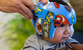 Besides good quality brands, you'll also find plenty of discounts when you shop for funny helmet during big sales. Pediatrics Transcend Orthotics Prosthetics