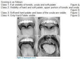 Image result for ASA Class