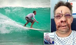 Utilize surfer's extensive modeling tools to display your data the way it deserves while maintaining accuracy and precision. Cornish Surfer 43 Needed A Facelift After Awful Wipeout Daily Mail Online