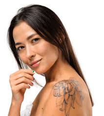 Laser Tattoo Removal in Texas