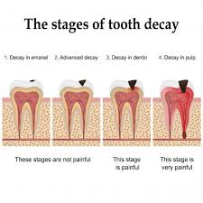 © pogil 2005, 2006 7/8. What Are 3 Indicators Of A Chemical Reaction