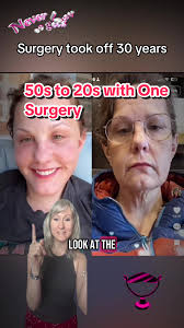 Loose Skin Removal in Mexico