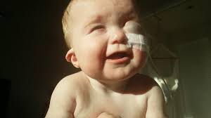 The One-in-a-Million Baby': Mom's Story of Parenting a Child With Complex  Disabilities