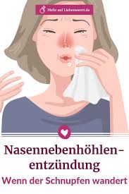 Rhinitis) gesprochen wird, sind meist vor allem die nasenschleimhäute betroffen. Pin Auf Alles Zum Thema Erkaltung