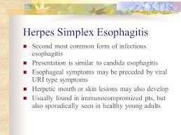 Esophagitis caused by cmv infection, most commonly occurring in patients with immunocompromise1,2,3. Morning Report Jieli Li 12 29 Ppt Video Online Download