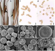 Image result for Anadelphia