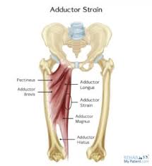 The injury is generally painful and uncomfortable. Adductor Groin Injuries In Soccer Players Active Pt Sports