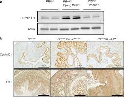 We did not find results for: B Catenin Mediates Glandular Formation And Dysregulation Of B Catenin Induces Hyperplasia Formation In The Murine Uterus Oncogene