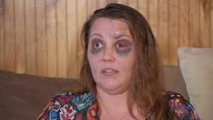 Witnesses thought a woman was dead after hit and run with 18-wheeler