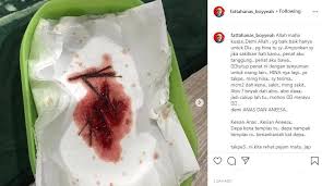 Meski demikian, peneliti juga menemukan 27 orang dari 41 sampel pasien yang dirawat di rumah sakit pada awal wabah pernah ke pasar hewan dan ikan laut di. Ampunkan Saya Jika Sakitkan Hati Kamu Papa Fattah Anas Dipercayai Kena Buatan Orang Mingguan Wanita