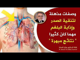 علاج ضغط الدم المرتفع بالأعشاب. Ø¹Ù„Ø§Ø¬ Ø§Ù„Ø­Ù„Ù‚ ÙˆØ§Ù„Ø²ÙƒØ§Ù…