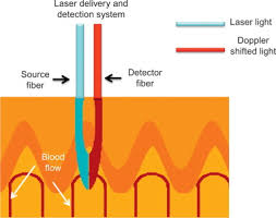 The source code of this svg is invalid due to an error. Doppler Effect An Overview Sciencedirect Topics