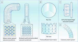 Irregular verb definition for 'to hurt', including the base form, past simple, past participle, 3rd person singular, present participle / gerund Illustrations Of Representative Vascular Implants A Woven And Knitted Download Scientific Diagram