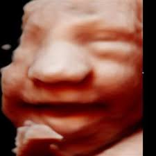 Love At First Sight 3D-Berwick