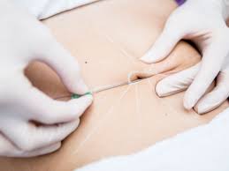 Here are some common reasons why your stomach may be getting bigger besides pregnancy and obvious over eating. Belly Button Plastic Surgery Procedures Are Trending For 2018 Allure