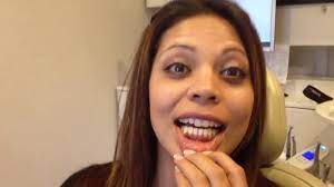Gingival Pigmentation Removal Dark Gums Gummy Smile Review Dark Gums Gum Lightening Pigmentation Treatment