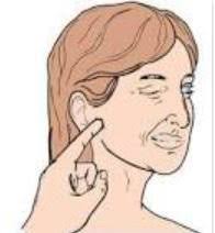 (medicine) one of the signs of tetany seen in hypocalcemia. Hektoen International On Twitter Frantisek Chvostek Was Born In Moravia But Achieved Prominence As A Physician In Vienna And Is Remembered For Describing The Chvostek Sign Of A Low Blood Calcium Elicited