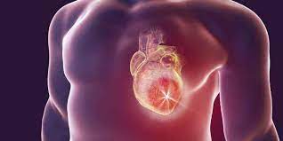 El oxígeno no llega al miocardio. Infarto De Miocardio Sintomas Tratamientos Causas E Informacion