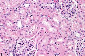 Kidney Renal Tubule Accumulation Hyaline Droplet Nonneoplastic Lesion Atlas
