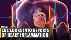Heart muscle inflammation (myocarditis) is an inflammatory process of the heart muscle, which can be acute or chronic in nature. Cdc Warns Over Heart Inflammation Cases Linked To Mrna Jabs Covid 19 Vaccine English World News Youtube