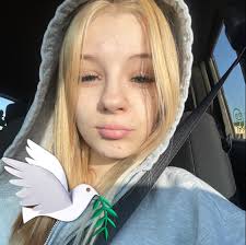 Especially if you've moved here and suddenly started experiencing eczema  I'd love to know. My doctor suggested that my eczema has gotten worse  because of the water is use and when I