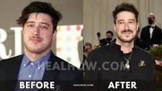 Marcus Mumford Weight Loss [2023]: Before and After