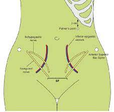 Palmer's technique is particularly useful in cases where umbilical entry is contraindicated, it is preferred to use the left upper quadrate for entry of veress needle. Vessels And Nerves Of The Anterior Abdominal Wall And Location Of The Download Scientific Diagram