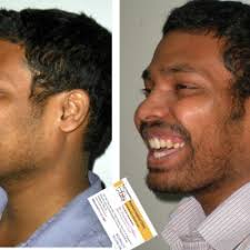 Dr. Dayanand Shirol (Noble Hospital) in Hadapsar,Pune