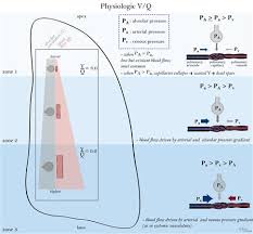 The assumption is that the partial pressure of co2 in the atmosphere is nearly 0 so we can drop part of the equation. V Q Mismatch Respiratory Medbullets Step 1