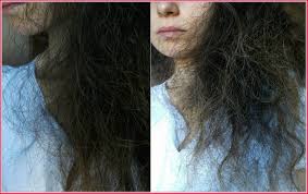 Take your fingertips and slide them into your roots. Pay Attention To Dry Skin Especially On Or Near The Scalp If You Have Very Dry Skin You May Also Have Very Dry Ha Hair Remedies Damaged Hair Moisturize Hair