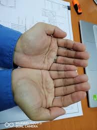 If you are learning about the palm lines, or have a double simian person in your life or if you are the owner of double simian lines Do You Have The Masukake Or Simian World Wide Weird Facebook