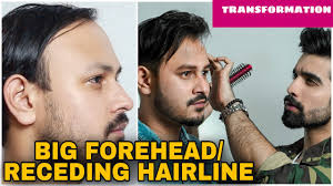 Check spelling or type a new query. 10 Best Hairstyles Big Forehead Transformation Receding Hairline Hairstyle Men Face Shape Youtube