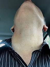 Wednesday Neck and Throat Pic | Jeremy V | Flickr