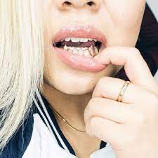 A wide variety of trendy urban styles, including pendants, chains, rings, shades and more. Grillz Designs Rich Grillz Gold Silver Custom Grillz Dc Md And Va