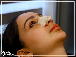 How to treat a broken nose. Nose Tape After Rhinoplasty Should You Skip It Step By Step Guide