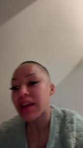 Except my dog 🙂 (not the vein coming back) #fyp