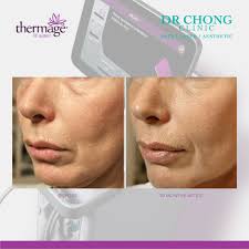 Unveil the power of transformation! 💪 Swipe left to witness the incredible  before-and-after journey with 𝐓𝐡𝐞𝐫𝐦𝐚𝐠𝐞. Tightened, toned, and  radiant — because every transformation tells a story. ✨💫 Contact us at  +𝟔𝟎𝟏𝟏-𝟐𝟏𝟓𝟎