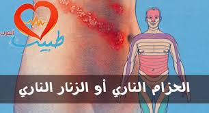 Maybe you would like to learn more about one of these? Ù‡Ù„ Ø§Ù„Ø­Ø²Ø§Ù… Ø§Ù„Ù†Ø§Ø±ÙŠ Ù…Ø¹Ø¯ÙŠ