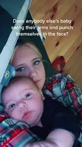 What Does It Mean When A Baby Hits His Face over and over Again