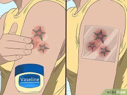 This post features some detailed evidence based information on how to cure a tattoo infection and tattoo ink allergy. 3 Ways To Treat An Infected Tattoo Wikihow