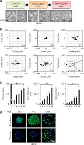 Vous avez été client de ce point de vente ? C Met Activation Leads To The Establishment Of A Tgfb Receptor Regulatory Network In Bladder Cancer Progression Nature Communications