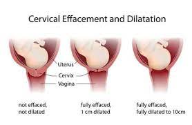 Why is checking the position of the cervix useful? Dilation Of The Cervix What You Need To Know Bellybelly